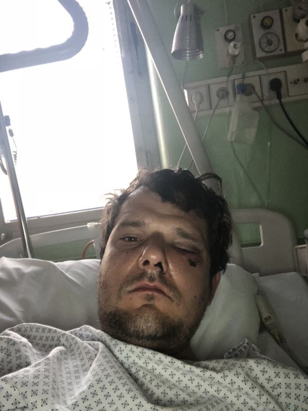 2 Poškozený.jpg